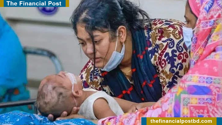 Caseload of measles, symptoms hits highest in a day; 7 children killed