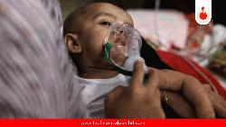 5 more die with measles, symptoms in 24 hours