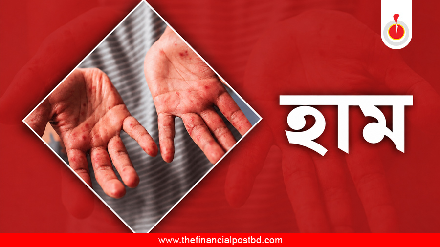 Measles: Death toll reaches 890 as 5 more children die in 24hrs